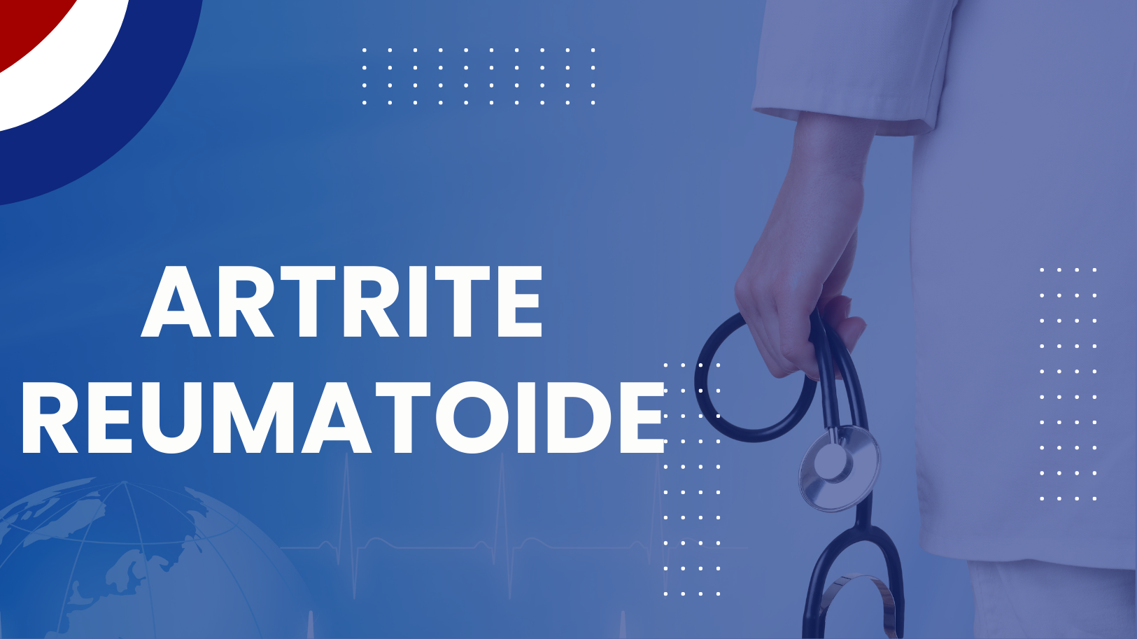 Artrite reumatoide
