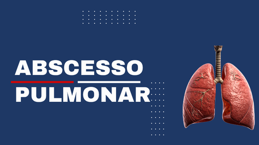 Abscesso Pulmonar