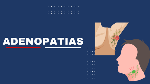 Adenopatias