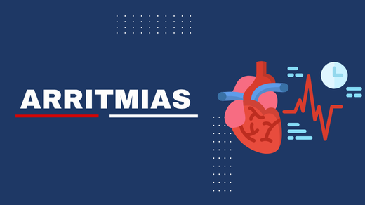 Arritimias