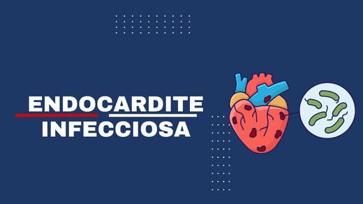 Endocardite Infecciosa