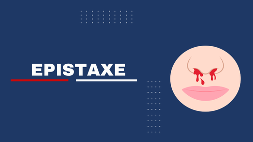Epistaxe