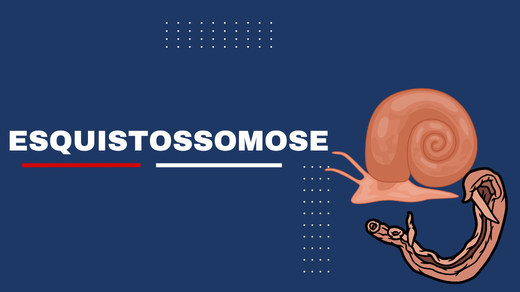Esquistossomose