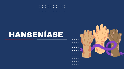 Hanseníase