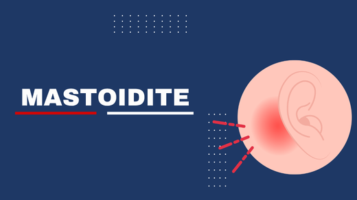 Mastoidite