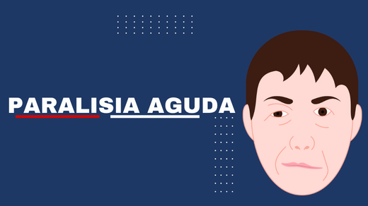 Paralisia Aguda