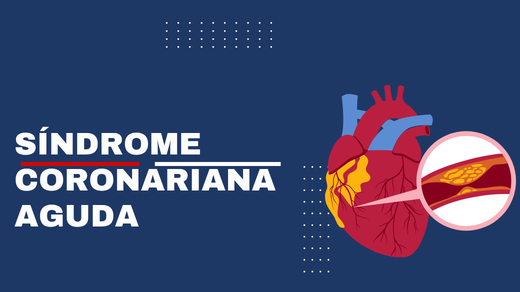 Síndrome coronariana aguda