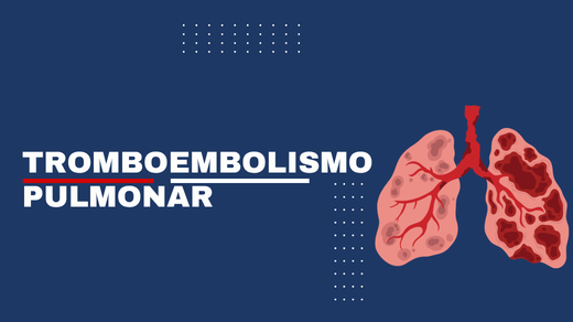 Tromboembolismo pulmonar