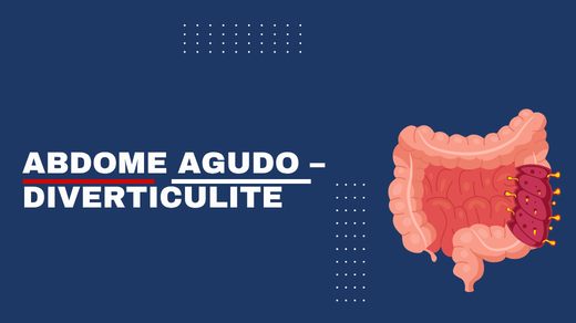 Abdome Agudo – Diverticulite
