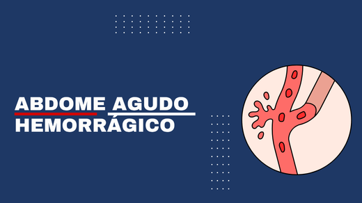 Abdome Agudo Hemorrágico