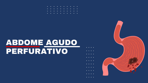 Abdome Agudo Perfurativo