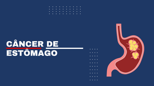 Câncer De Estômago
