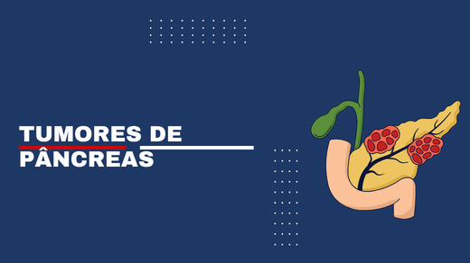 Tumores De Pâncreas