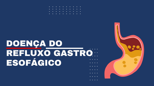 Doença Do Refluxo Gastro Esofágico