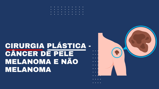 Cirurgia Plástica - Câncer De Pele Melanoma E Não Melanoma