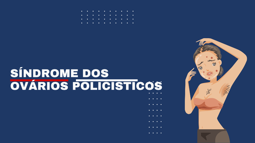 Síndrome Dos Ovários Policísticos